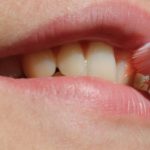 再石灰化は唾液の作用！　虫歯は再石灰化と脱灰とのせめぎ合い！？