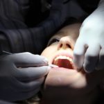 歯への外傷で抜けた歯は「再植」可能！！　歯の状態と注意点とは？